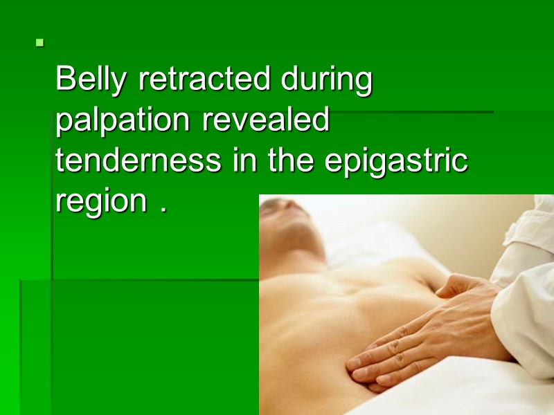 Belly retracted during palpation revealed tenderness in the epigastric region .